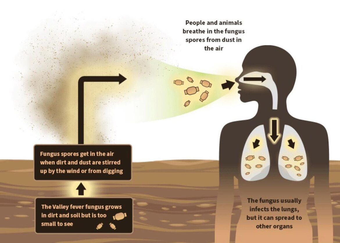 California droughts boosts the Valley Fever fungus